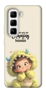 Чохол на Infinix Hot 50 Pro You are amazing фото 1 з 1