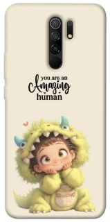 Чехол на Xiaomi Redmi 9 You are amazing фото 1 из 1