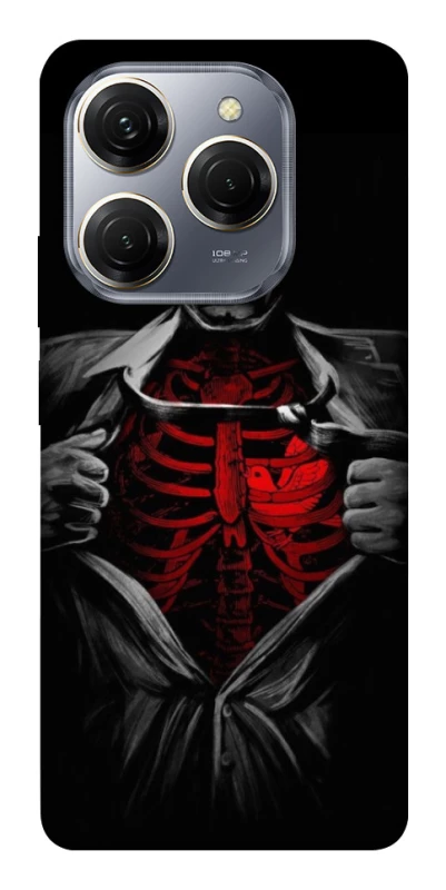 Чехол на TECNO Spark 20 Pro Skeleton Heart фото 1 из 1