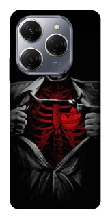Чохол на TECNO Spark 20 Pro Skeleton Heart фото 1 з 1