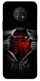Чохол на Nokia G50 Skeleton Heart фото 1 з 1
