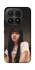 Чохол на Xiaomi 17 Lisa - BLACKPINK фото 1 з 1
