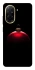 Чохол на Xiaomi Redmi A5 (Europe version) Christmas bauble фото 1 з 1