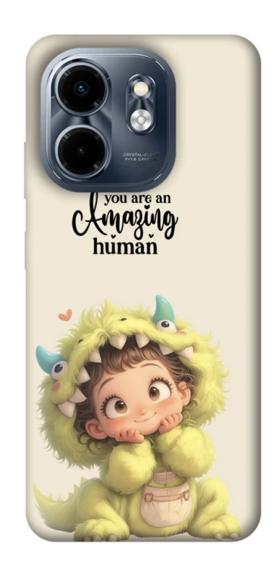 Чохол на Infinix Smart 9 4G / Hot 50i You are amazing фото 1 з 1