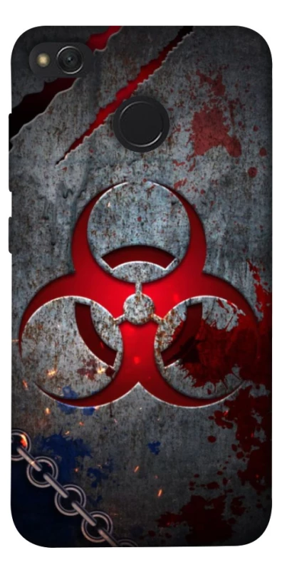 Чохол на Xiaomi Redmi 4X Радіація v3 фото 1 з 1