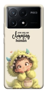 Чехол на Xiaomi Poco X6 You are amazing фото 1 из 1