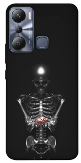 Чехол на Infinix Hot 20i Скелетон фото 1 из 1
