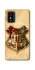 Чохол на ZTE Blade L9 Harry Potter mood v1 фото 1 з 1