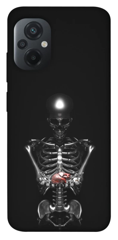 Чехол на Xiaomi Poco M5 Скелетон фото 1 из 1