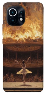 Чохол на Xiaomi Mi 11 Ballet фото 1 з 1