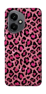 Чохол на Honor 400 Leopard Skin v3 фото 1 з 1