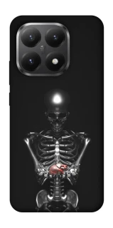 Чохол на Xiaomi 15T Скелетон фото 1 з 1