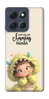 Чехол на Motorola Moto G86 Power You are amazing фото 1 из 1