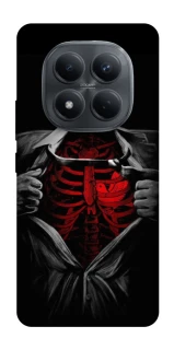 Чехол на Xiaomi Redmi Note 15 Pro 4G Skeleton Heart фото 1 из 1