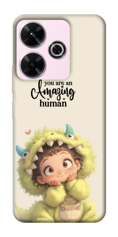 Чохол на Xiaomi Redmi 13 4G You are amazing фото 1 з 1