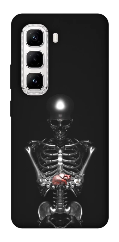 Чохол на Infinix Hot 50 Pro Скелетон фото 1 з 1