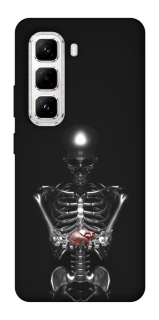 Чехол на Infinix Hot 50 Pro Скелетон фото 1 из 1