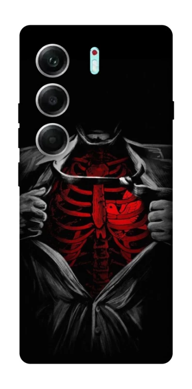 Чохол на Tecno Camon 40 Pro 5G Skeleton Heart фото 1 з 1