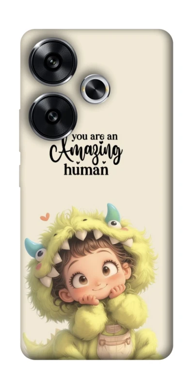 Чохол на Xiaomi Poco F6 You are amazing фото 1 з 1