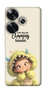 Чохол на Xiaomi Poco F6 You are amazing фото 1 з 1