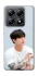 Чохол на Xiaomi 14T Pro Jungkook - BTS фото 1 з 1