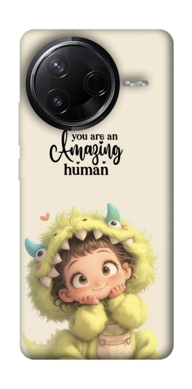 Чохол на Infinix Note 50 Pro You are amazing фото 1 з 1