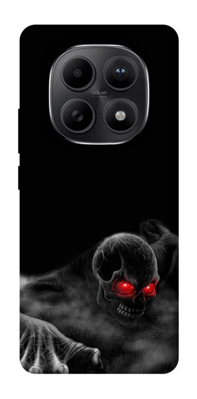 Чохол на Xiaomi Redmi Note 15 5G Skeleton v3 фото 1 з 1