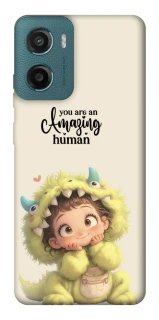 Чехол на Motorola Moto G06 You are amazing фото 1 из 1