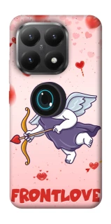 Чохол на Xiaomi 15T Frontlove фото 1 з 1