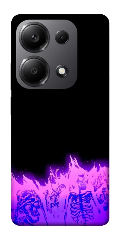 Чехол на Xiaomi Redmi Note 13 Pro 5G Funny moments фото 1 из 1