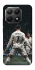 Чохол на Xiaomi 15T Ronaldo фото 1 з 1