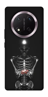 Чохол на Honor X9c Скелетон фото 1 з 1