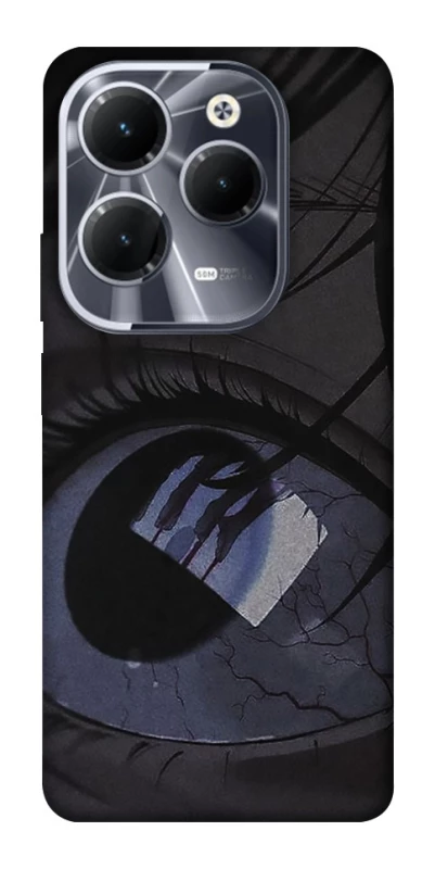 Чохол на Infinix Hot 40 Pro Eye фото 1 з 1