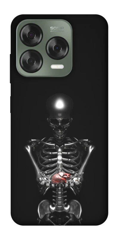 Чохол на ZTE Nubia V70 Design Скелетон фото 1 з 1