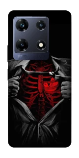 Чехол на Infinix Note 30 Pro Skeleton Heart фото 1 из 1