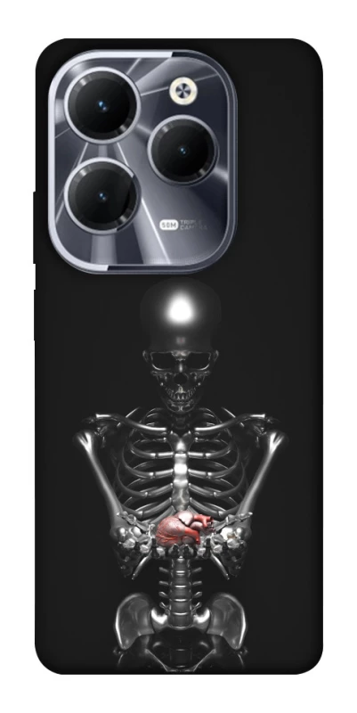 Чохол на Infinix Hot 40 Pro Скелетон фото 1 з 1