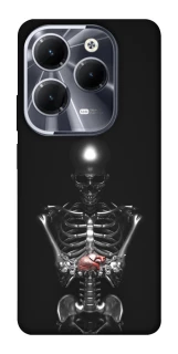 Чохол на Infinix Hot 40 Pro Скелетон фото 1 з 1