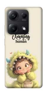 Чохол на Xiaomi Redmi Note 14S You are amazing фото 1 з 1