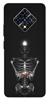 Чохол на Infinix Zero 8 Скелетон фото 1 з 1