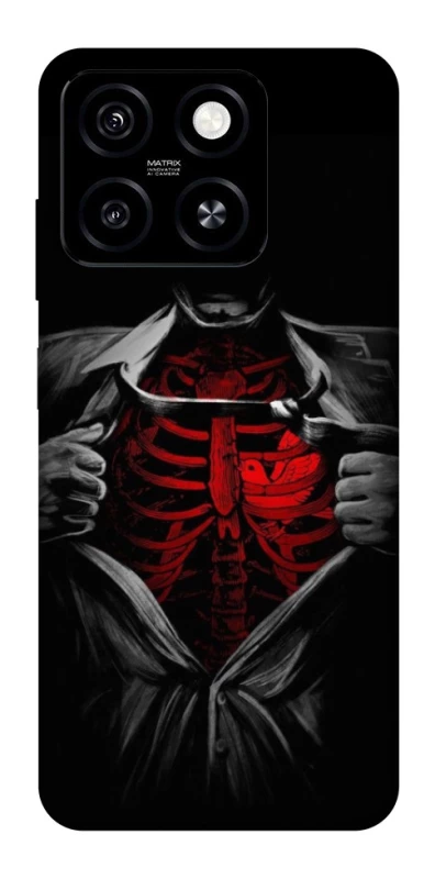 Чохол на ZTE Blade A55 4G Skeleton Heart фото 1 з 1