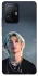 Чохол на Xiaomi 11T / 11T Pro Felix - Stray Kids фото 1 з 1