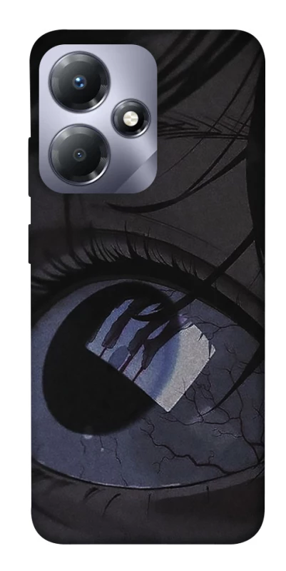 Чохол на Infinix Hot 30i Eye фото 1 з 1