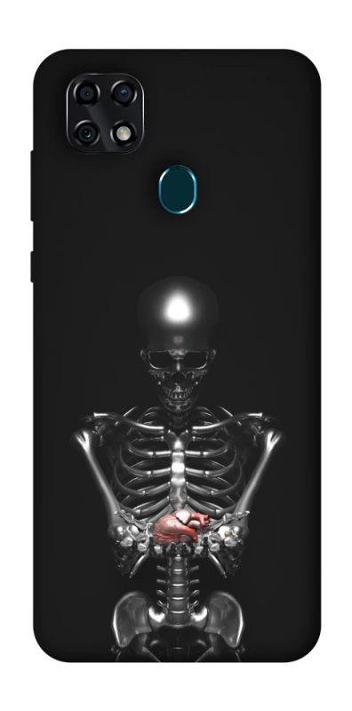 Чохол на ZTE Blade 20 Smart Скелетон фото 1 з 1