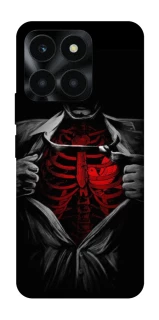Чохол на Huawei Honor X6a Skeleton Heart фото 1 з 1