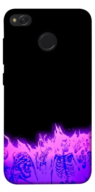 Чехол на Xiaomi Redmi 4X Funny moments фото 1 из 1