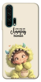 Чехол на Huawei Honor 20 Pro You are amazing фото 1 из 1