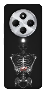 Чохол на Xiaomi Redmi 14C / Poco C75 Скелетон фото 1 з 1