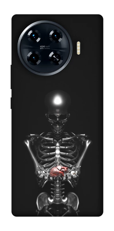 Чохол на TECNO Spark 20 Pro+ Скелетон фото 1 з 1