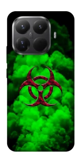 Чохол на Xiaomi 15T Pro Радіація фото 1 з 1