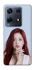 Чохол на Infinix Note 30 Pro Ahyeon - BABYMONSTER фото 1 з 1